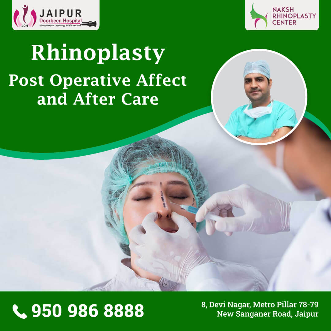 Rhinoplasty - Post Operative Affect and After Care
