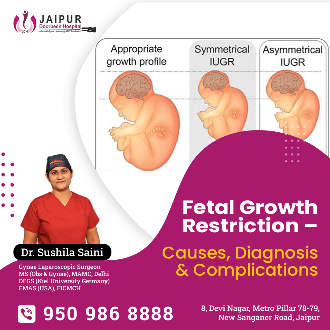 Fetal Growth Restriction – Causes, Diagnosis & Complications