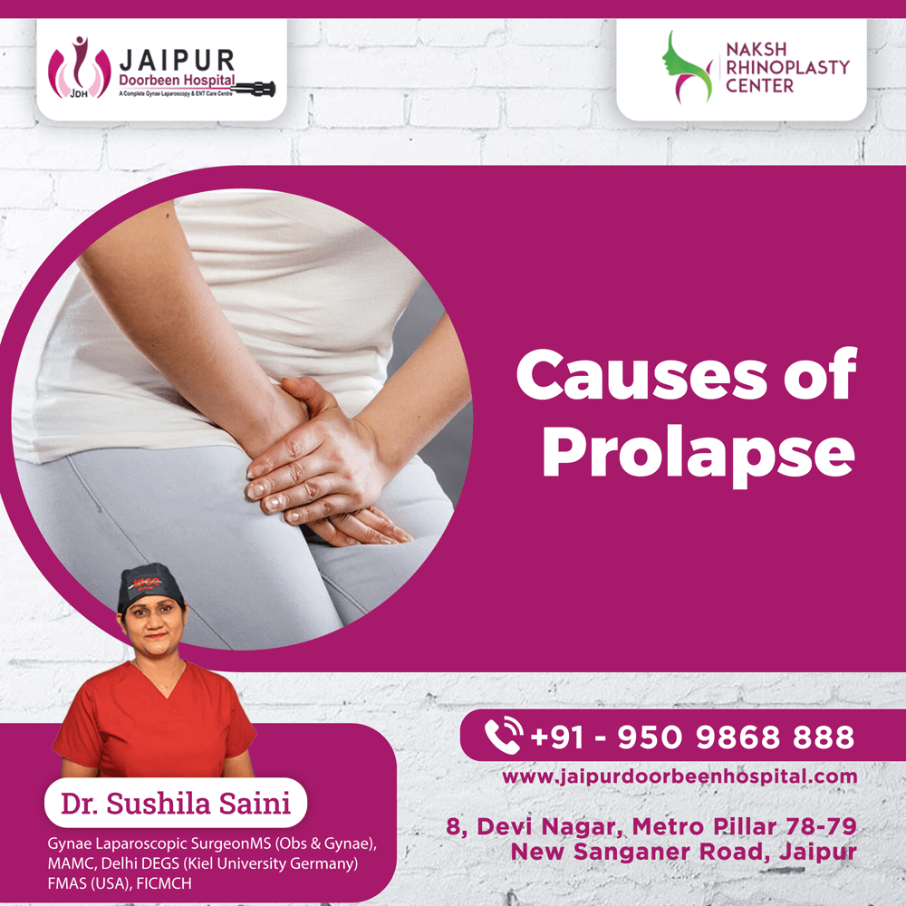 Causes of Prolapse