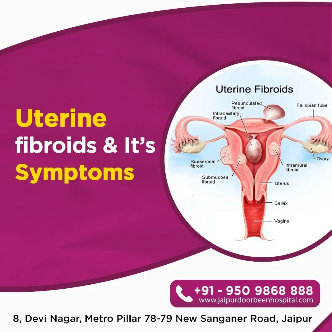 Uterine fibroids & It's Symptoms