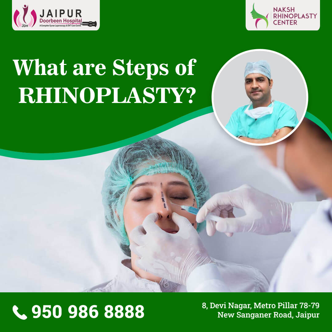 What are Steps of RHINOPLASTY?