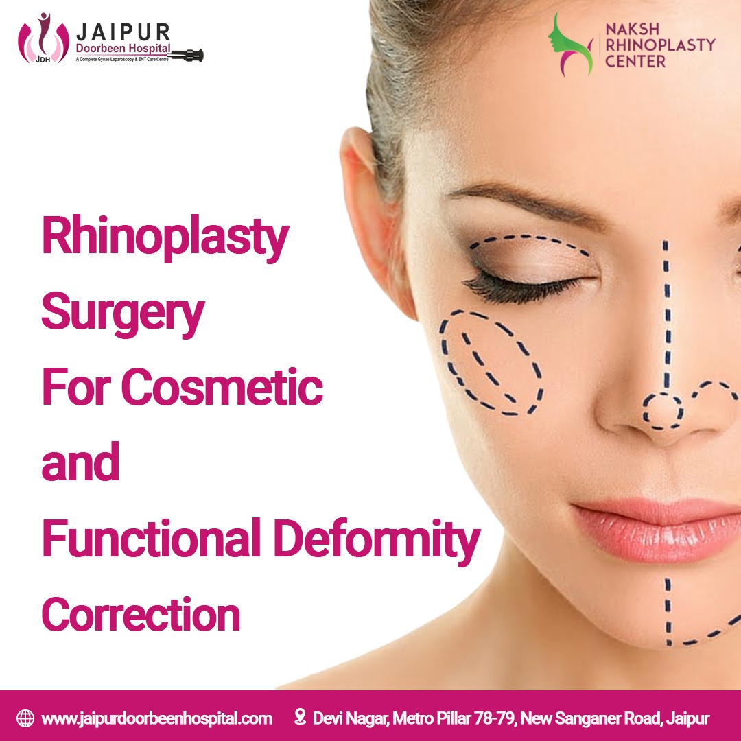 Rhinoplasty surgery for cosmetic and functional deformity correction