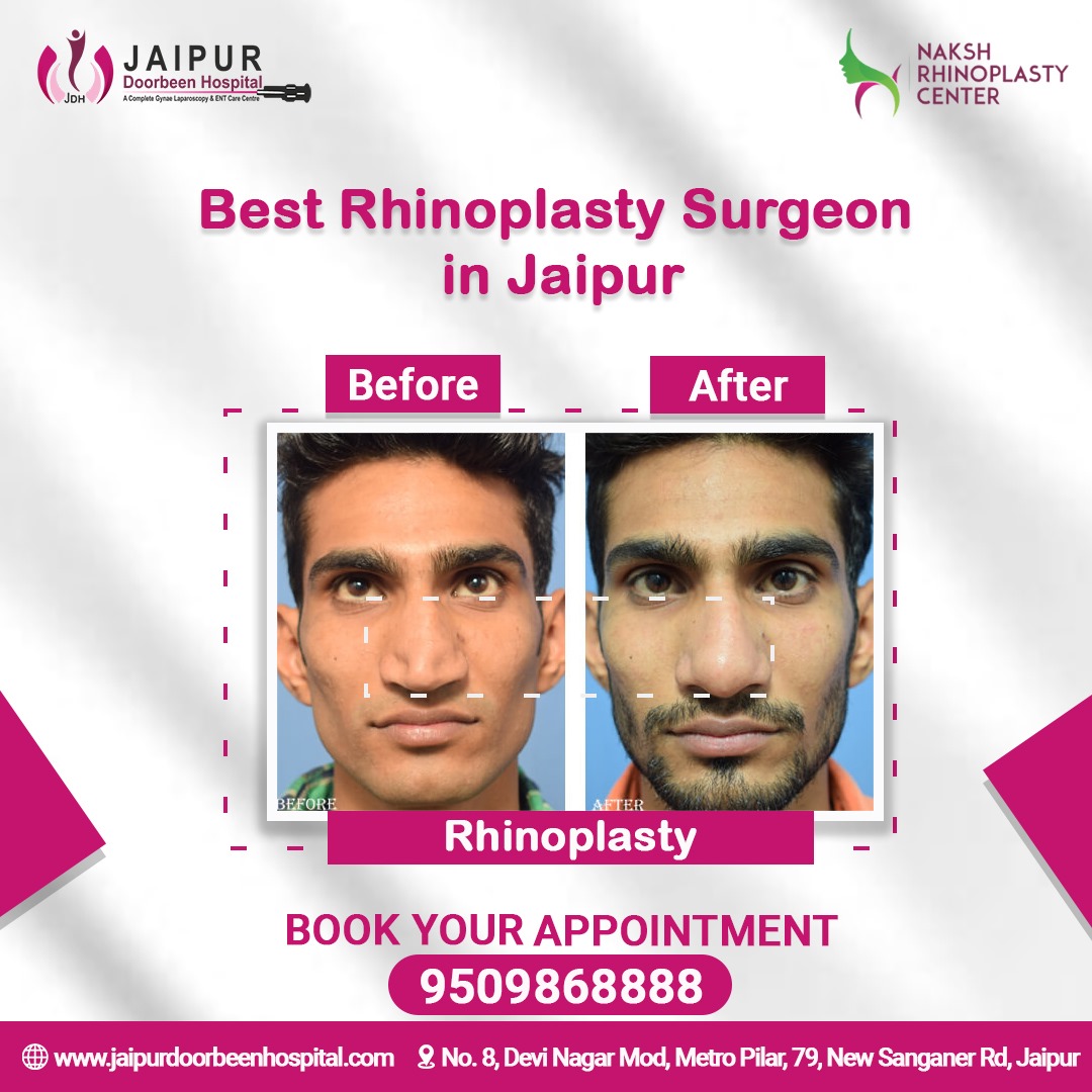 Best Rhinoplasty surgeon in Jaipur