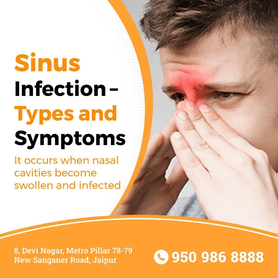 Sinus Infection – Types and Symptoms