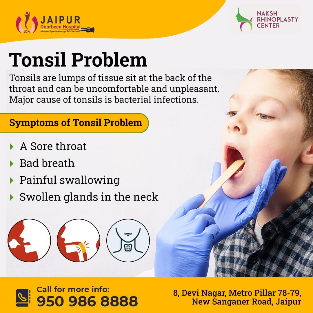 Tonsils : Symptoms & Causes